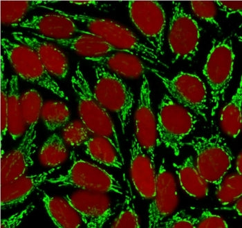 HSP60 Antibody