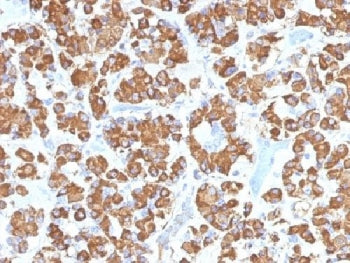 IHC testing of FFPE human pituitary gland with GH antibody (clone GH/1450). Required HIER: boil tiss