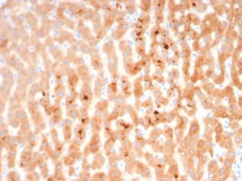 Bradykinin Antibody / Kininogen