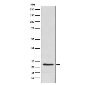 CSH1 Antibody / Placental Lactogen