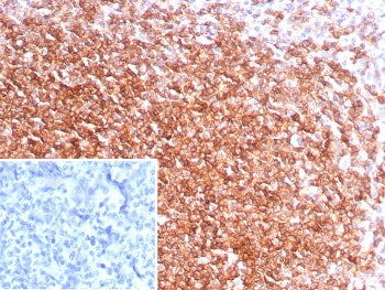 CXCR5 Antibody / BLR1 / MDR15
