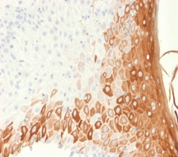 KRT10 Antibody / Cytokeratin 10