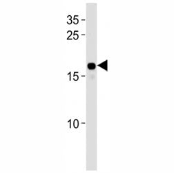 HMGA2 Antibody