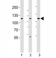 JAK1 Antibody
