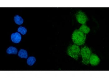 Immunofluorescent staining of FFPE human HepG2 cells with EEF2K antibody (green) and DAPI nuclear st