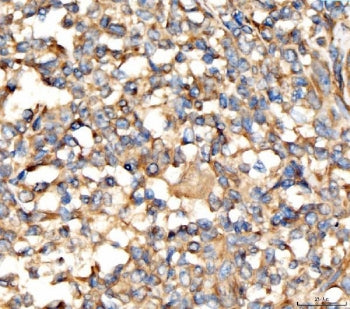 AP2A2 Antibody / AP-2 complex subunit alpha-2