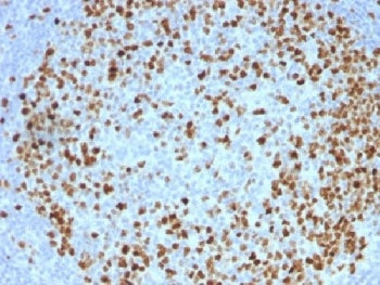 Topoisomerase II alpha Antibody / TOP2A
