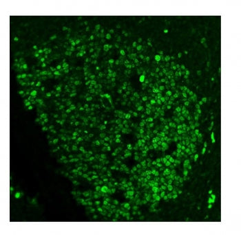 Ki-67 Antibody