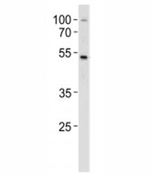 SOX4 Antibody
