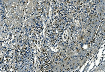 IHC staining of FFPE human appendicitis tissue with Azurocidin antibody. HIER: boil tissue sections in pH8 EDTA for 20 min and allow to cool before testing.