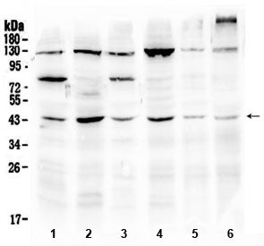 Western blot testing of 1) rat brain, 2) rat testis, 3) mouse brain, 4) mouse testis, 5) human U-2 O