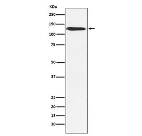 SNF2H Antibody / SMARCA5