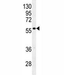 Glypican 3 Antibody (GPC3)