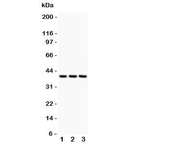 CXCR6 Antibody