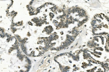 PHEX Antibody / PEX / HYP
