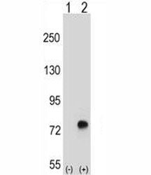 Western blot analysis of TGFBI antibody and 293 cell lysate either nontransfected (Lane 1) or transi