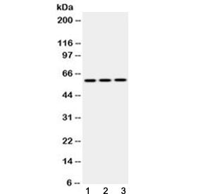 Western blot testing of 1) rat brain, 2) mouse NIH3T3 and 3) human HepG2 lysate with Cytokeratin 14 