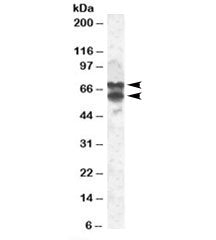 PPP2R5D Antibody