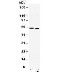 ACCN1 Antibody / ASIC2