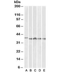 Aurora B Antibody