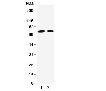 Western blot testing of Transglutaminase 2 antibody and Lane 1: Jurkat; 2: HeLa cell lysate. Predict