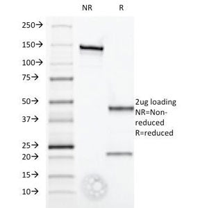SDS-PAGE Analysis of Purified, BSA-Free Interferon alpha Antibody (clone 2.52). Confirmation of Inte