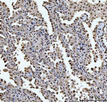HOXC4 Antibody