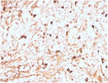 IHC staining of FFPE human spleen tissue with recombinant Lambda Light Chain antibody (clone LLC/377