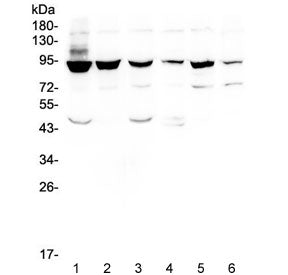 Western blot testing of human 1) HeLa, 2) PC-3, 3) Caco-2, 4) A549, 5) K562 and 6) Raji cell lysate 