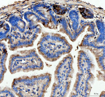 IHC analysis of Lysozyme using anti-Lysozyme antibody. Lysozyme was detected in a paraffin-embedded 