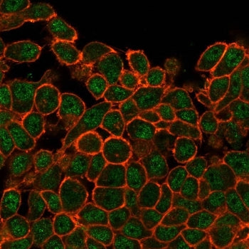 SATB1 Antibody