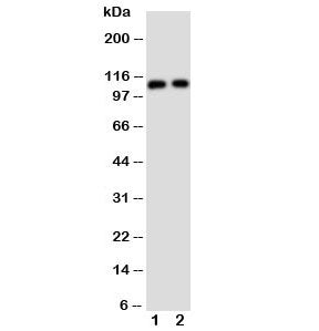 Western blot testing of TRPC6 antibody and Lane 1: rat lung; 2: human 293T cell lysate. Predicted mo
