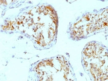 IHC: Formalin-fixed, paraffin-embedded human testicular carcinoma stained with Perlecan antibody (A7
