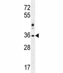 NKX1.2 Antibody