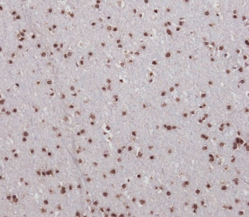 SIM1 Antibody / Single-minded homolog 1