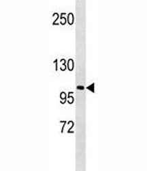 LOXL2 Antibody