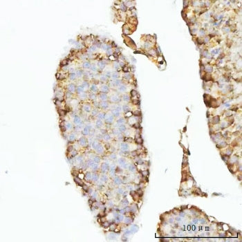 GHRH Antibody / Somatoliberin
