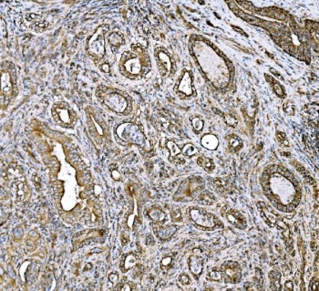 Pyruvate Dehydrogenase E2 Antibody / DLAT