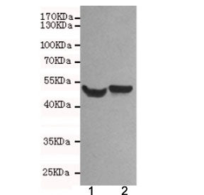 NSE Antibody / Neuron Specific Enolase