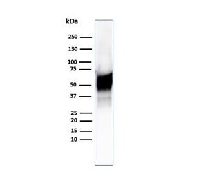 Western blot testing of human Hep2 cell lysate using recombinant HSP60 antibody (clone HSPD1/6496R).