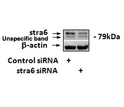 STRA6 Antibody
