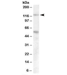 Western blot testing of human umbillical cord lysate with Palladin antibody at 0.1ug/ml. Predicted m