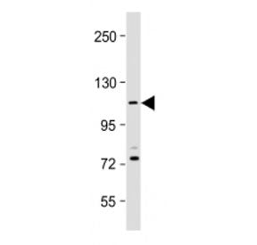 PKN1 Antibody (C-Terminal)