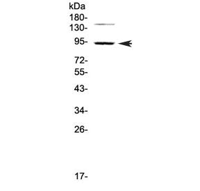 Western blot testing of human HeLa cell lysate with PDE4D antibody at 0.5ug/ml. Predicted molecular 