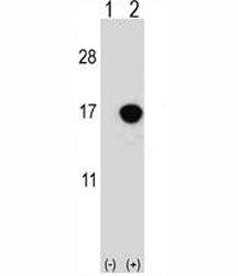Western blot analysis of CDKN2B antibody and 293 cell lysate either nontransfected (Lane 1) or trans