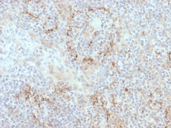 IHC staining of FFPE human tonsil with TIM-3 antibody. HIER: boil tissue sections in pH 9 10mM Tris 