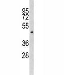 Integrin linked kinase Antibody (ILK)