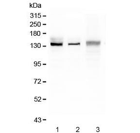 Western blot testing of 1) rat liver, 2) mouse liver and 3) mouse HEPA1-6 lysate with CP antibody. E