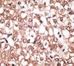 ABCB11 Antibody