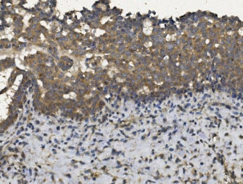 EIF2AK4 Antibody / GCN2
